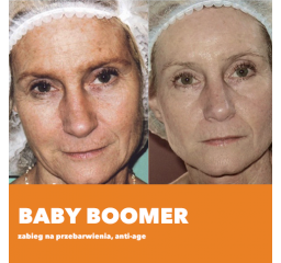 Baby Boomer - zabieg na przebarwienia, anti-age