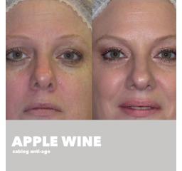 Apple Wine - zabieg anti-age, skóra odwodniona