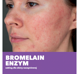 Bromelain Enzym - zabieg dla skóry naczyniowej.